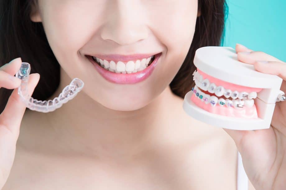 Can Invisalign Fix An Underbite?