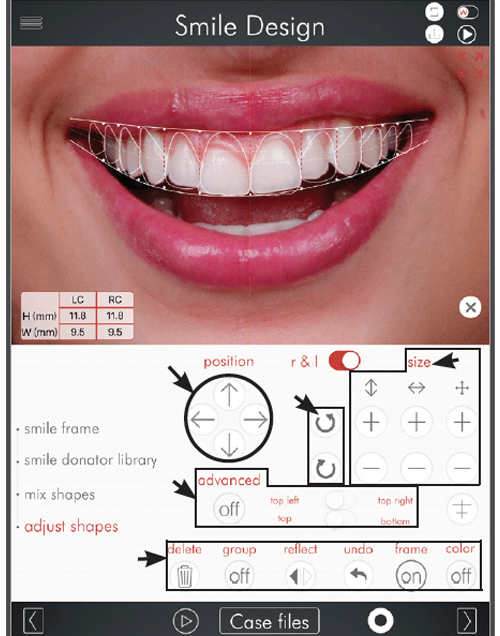 Step 3 DSD Photo