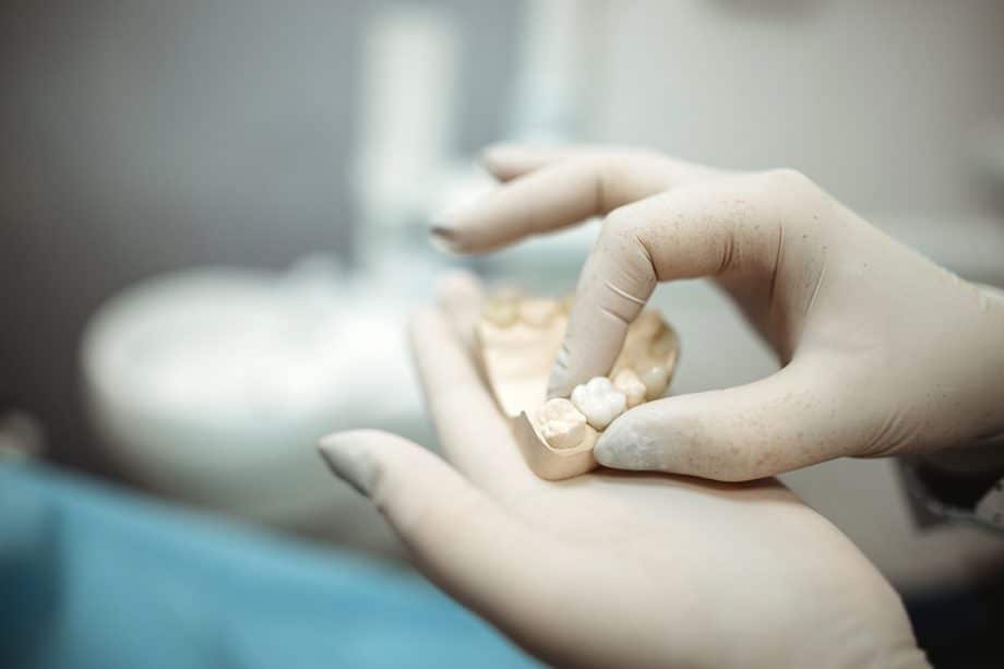 How Long After A Root Canal Should I Wait to Get a Crown?