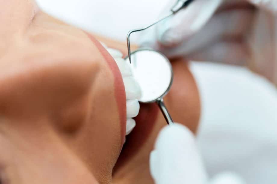 patient in the middle of a dental exam